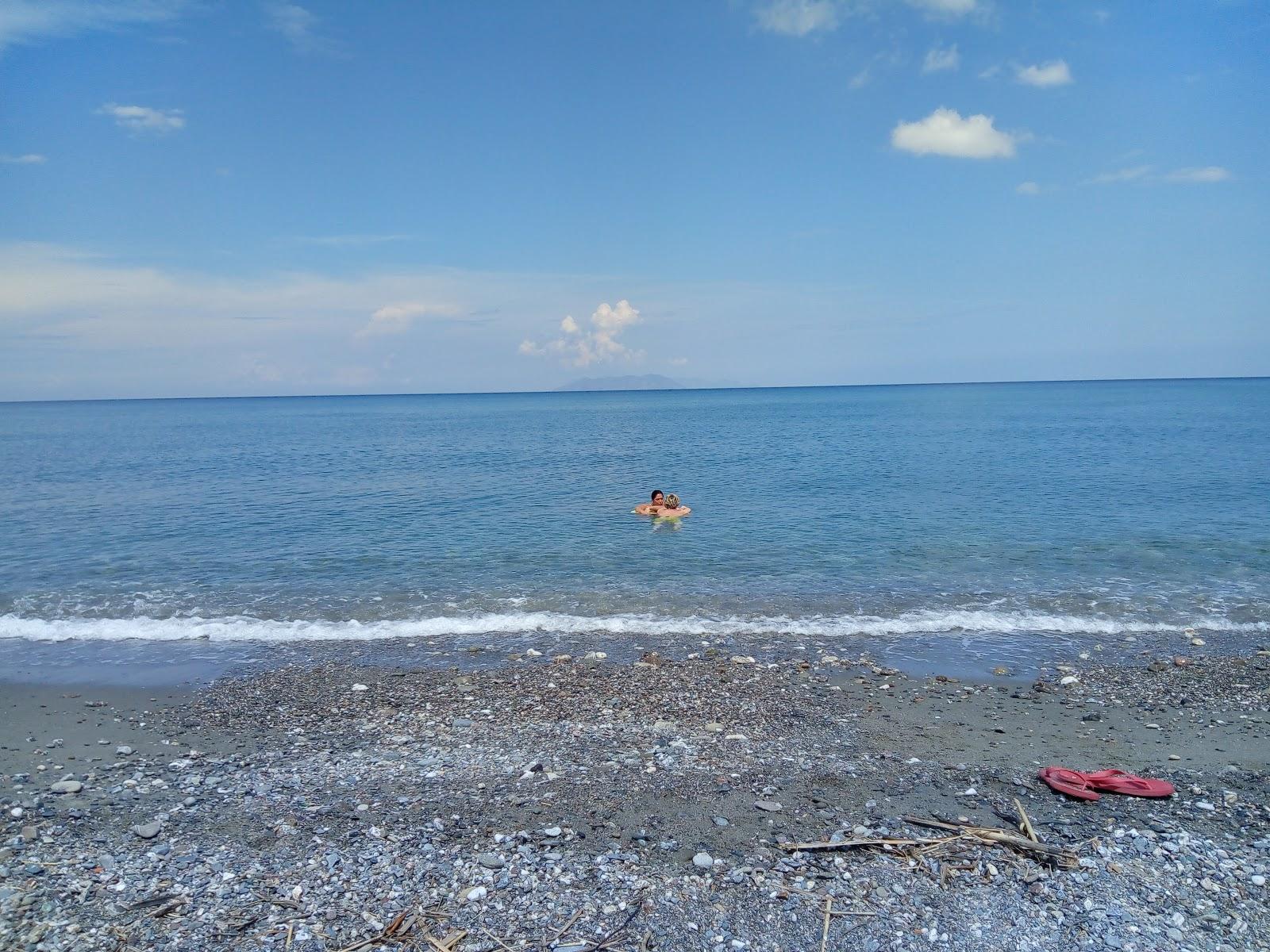 Sandee - Lido Baia Di Venere